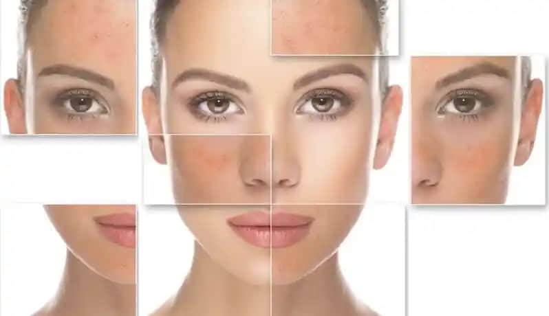 Hassas Ciltler İçin Doğru Bakım Yöntemleri ve Uygun Ürün Seçimi Rehberi