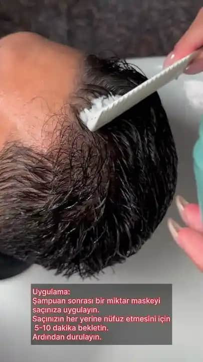 Kepekli Saça Etkili Çözüm Yolları ve Sağlıklı Parlak Saçlara Ulaşma Rehberi