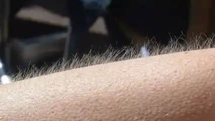 Kılları Azaltmanın En Etkili Yolları: Güncel ve Doğal Yöntemler Hakkında Bilgiler