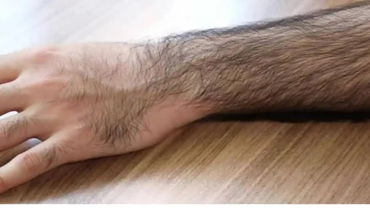 Kol Kıllarını Tüy Dökücüyle Almak: Güvenli ve Etkili Yöntemler Rehberi