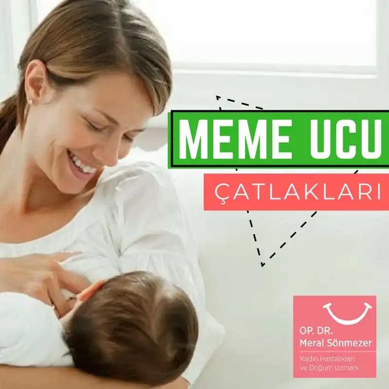 Meme Başındaki Çatlaklara Karşı Etkili Bakım Yöntemleri ve Doğal Çözüm Tavsiyeleri