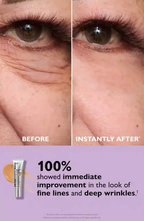 Peter Thomas Roth Instant FIRMx Eye ile Göz Çevresi Sıkılaştırıcı ve Gençleştirici Bakım