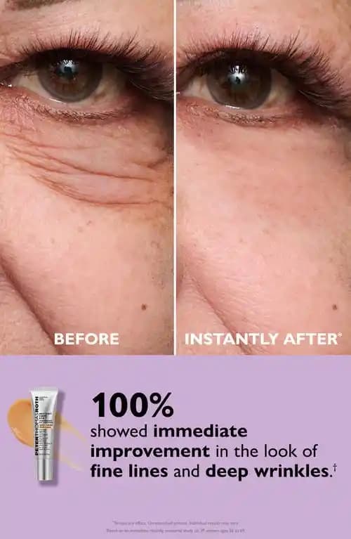 Peter Thomas Roth Instant FIRMx Eye ile Göz Çevresi Sıkılaştırıcı ve Gençleştirici Bakım