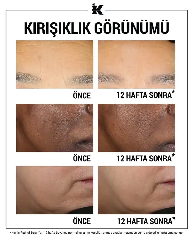 Retinol Nedir ve Cilt Sağlığını Artıran Etkileri Nelerdir