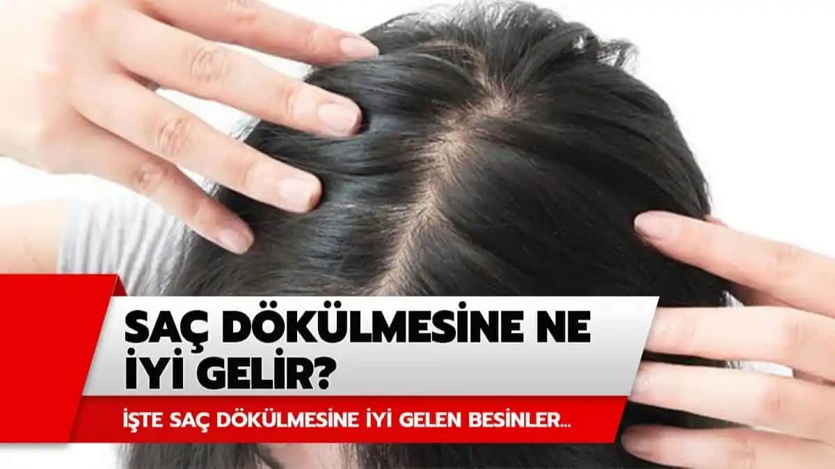 Saç Derisi Dökülmesine Karşı Etkili Çözüm Yolları ve Bakım İpuçları