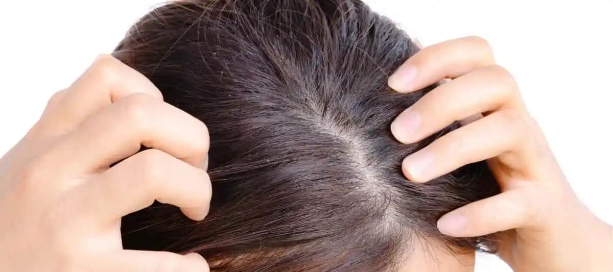 Saç Derisine İyi Gelen Yöntemler ve Sağlıklı Saçlar İçin Uygulanabilir Tavsiyeler