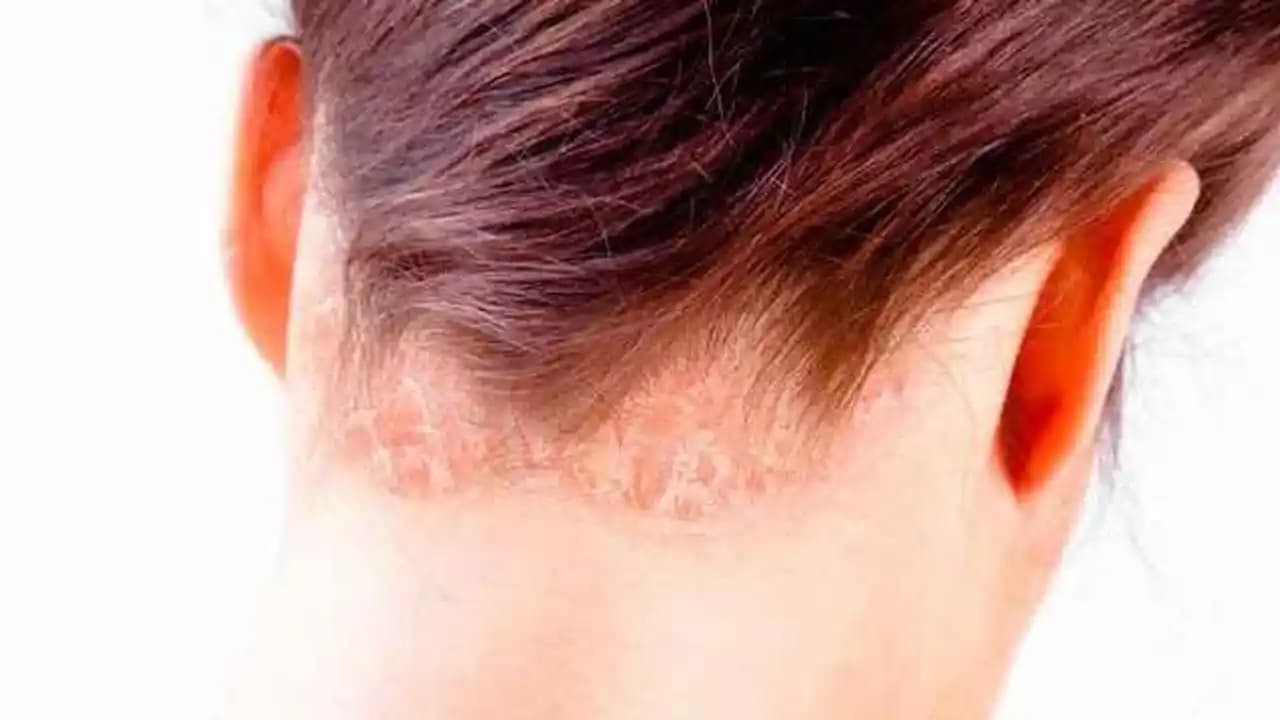 Saç Gözeneklerini Açma Yöntemleri ve Saç Sağlığını Koruma İpuçları