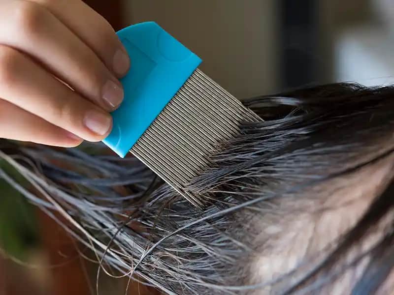 Saçtaki Biteye Karşı En Etkili Yöntemler ve Doğal Çözümler Hakkında Bilgi