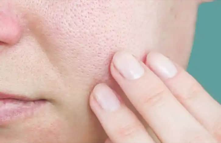 Tıkanmış Gözenekler ve Cilt Sağlığı İçin Etkili Temizlik ve Bakım Yöntemleri