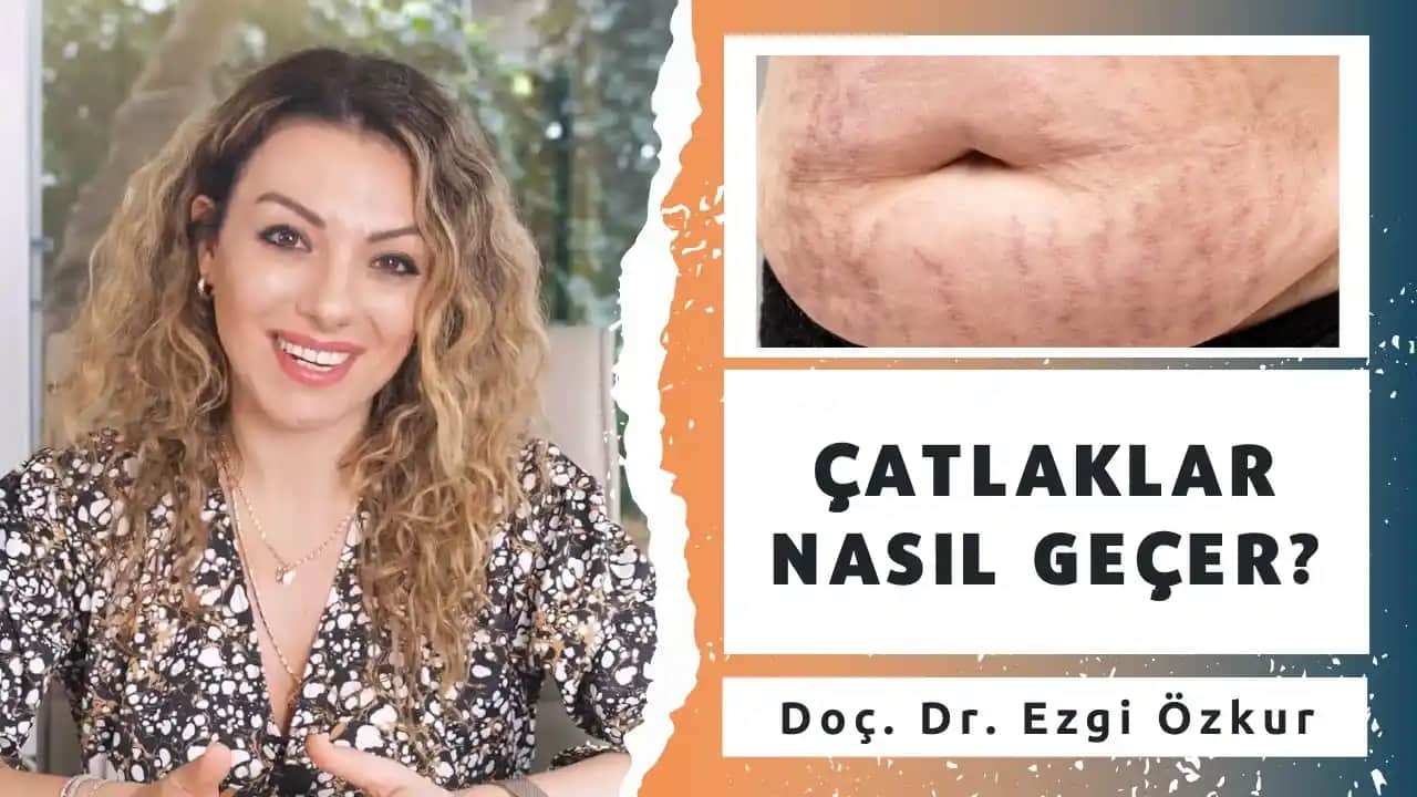 Yeni Oluşan Çatlakların Giderilmesi için Etkili Yöntemler ve Doğal Çözüm Tavsiyeleri