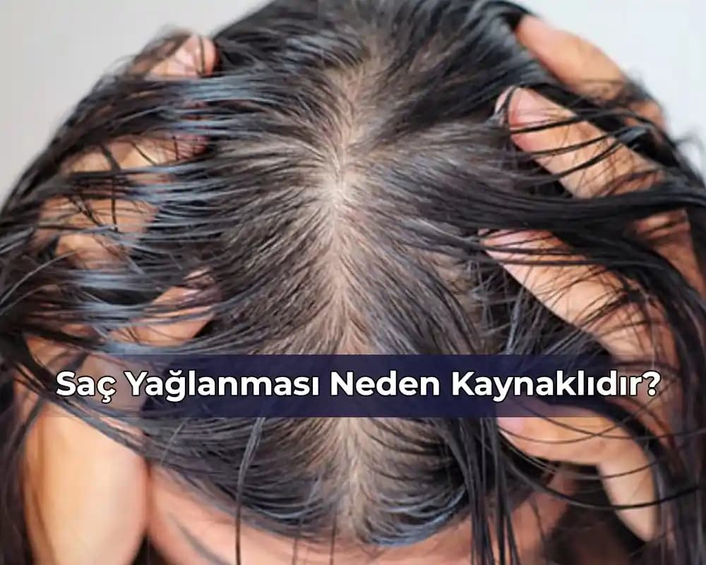Yüz ve Saç Yağlanmasının Nedenleri ve Etkili Kontrol Yöntemleri