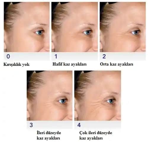 Yüzde Yaşlanma Belirtileri ve Cilt Sağlığını Koruma Yöntemleri