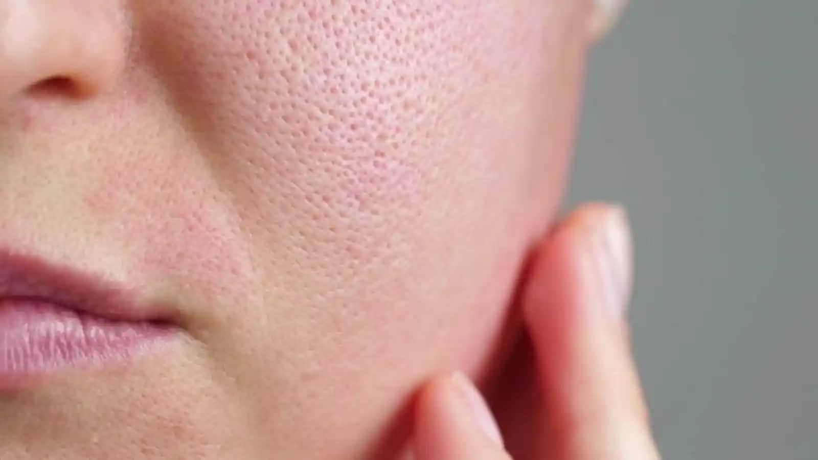 Yüzdeki Gözeneklerin Büyüme Nedenleri ve Etkili Cilt Bakım Yöntemleri Hakkında Kapsamlı Bilgi