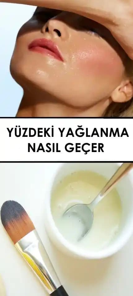 Yüzdeki Yağlar Nasıl Azaltılır Sağlıklı ve Kalıcı Çözüm Yolları