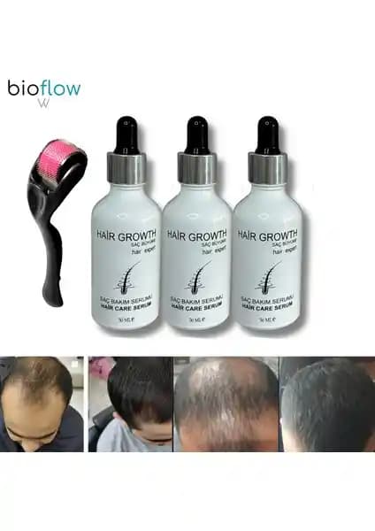 Bioflow Saç Serum ve Roller Seti ile Doğal İçeriklerle Saç Dökülmesini Destekleyen Canlılık
