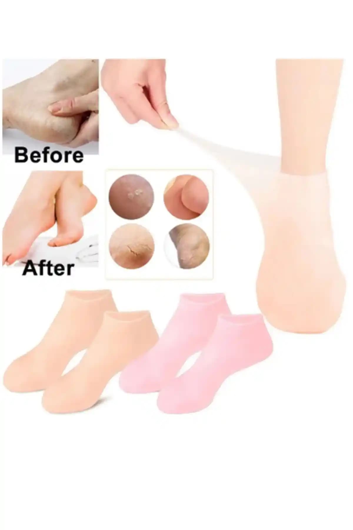 Genel Markalar Silikon Nemlendirici Ayak Maskesi: Evde Spa Etkisi ve Uygulama Özellikleri