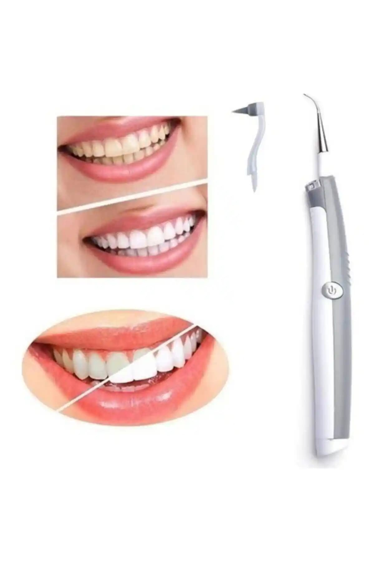 Hersepete Sonic Pic Ultrasonik Diş Temizleme Aleti ile Evde Etkili ve Hassas Bakım