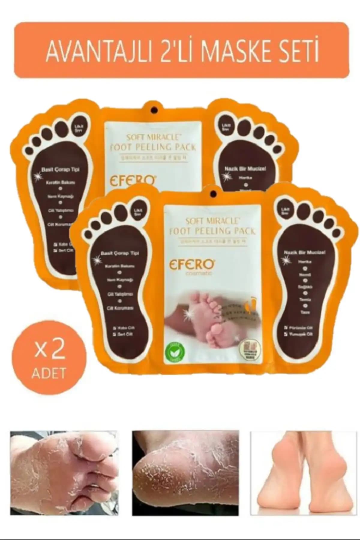 Efero Ayak Soyuk Çorap ve Mjcare Miracle Foot Peeling Pack Karşılaştırması 1