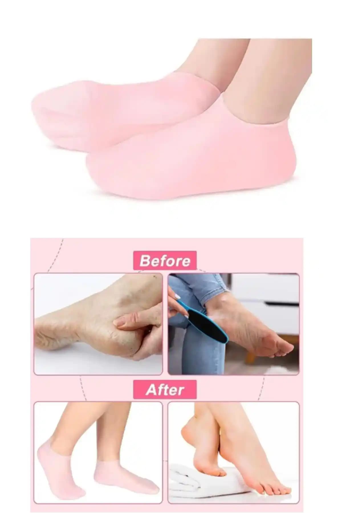 İndirimKap Silikon Nemlendirici ve Jigott Miracle Ayak Maskeleri Karşılaştırması