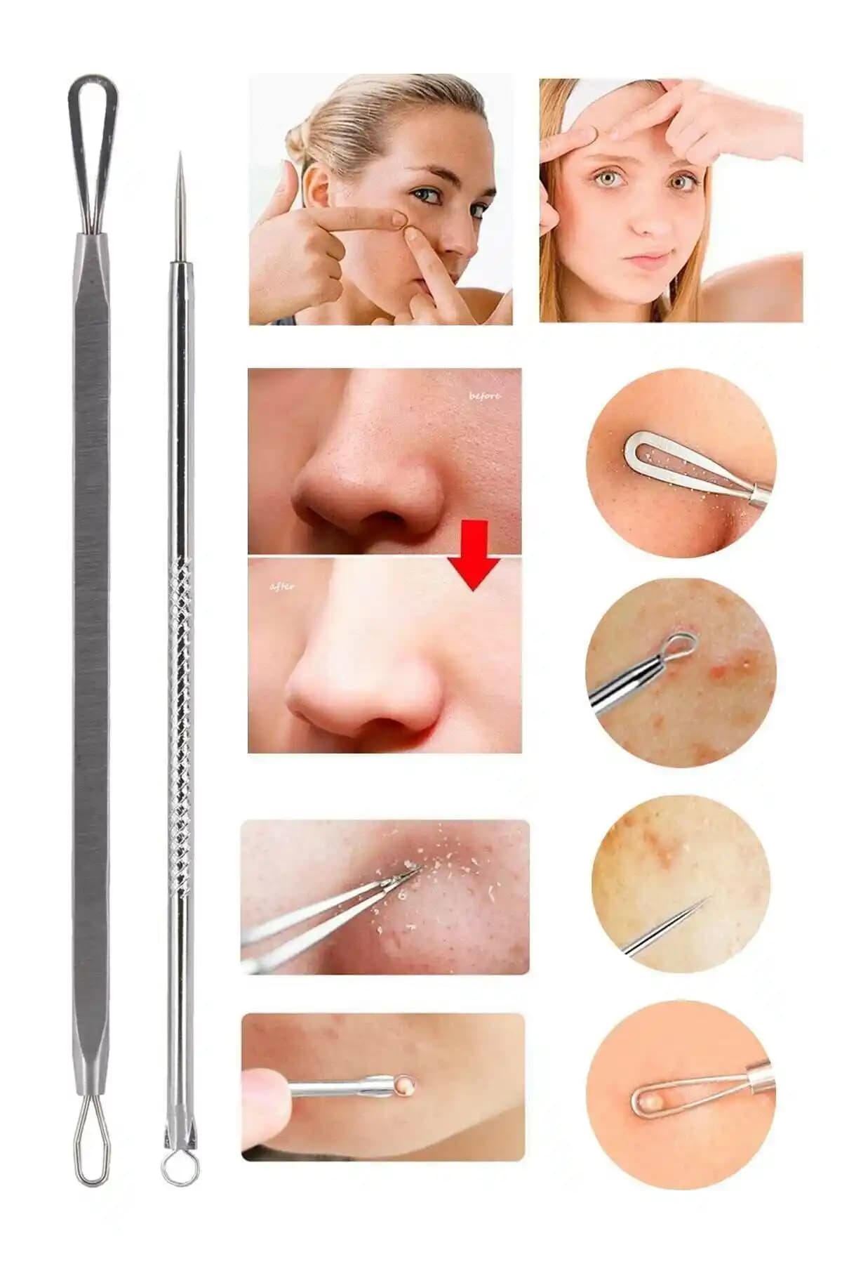 Ocean Akne Siyah Nokta Temizleyici Komedon Cihazı ile Güvenli ve Pratik Cilt Bakımı