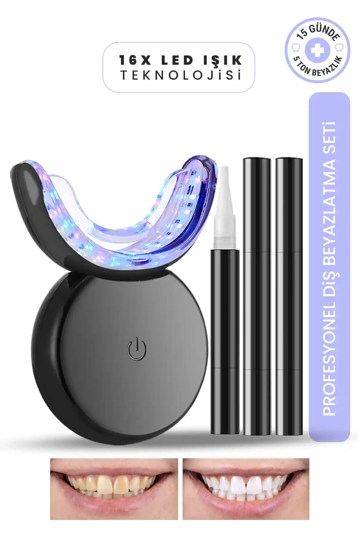 MOEN Profesyonel Diş Beyazlatma Seti 16 LED ile Hızlı ve Güvenilir Sonuçlar