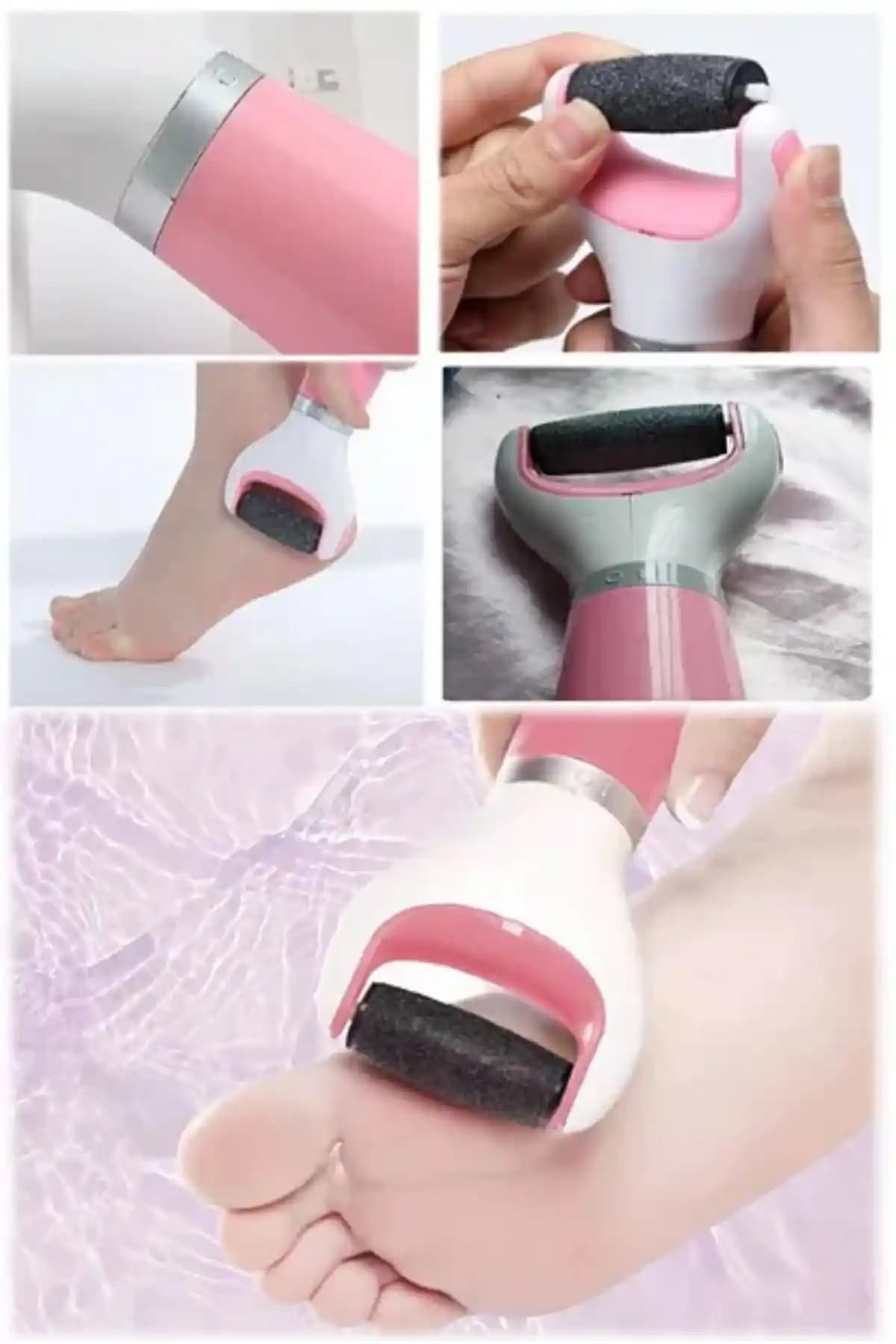 Mortingen Ayak Sert Ölü Cilt Çıkarma Cihazı İncelemesi ve Kullanıcı Yorumları