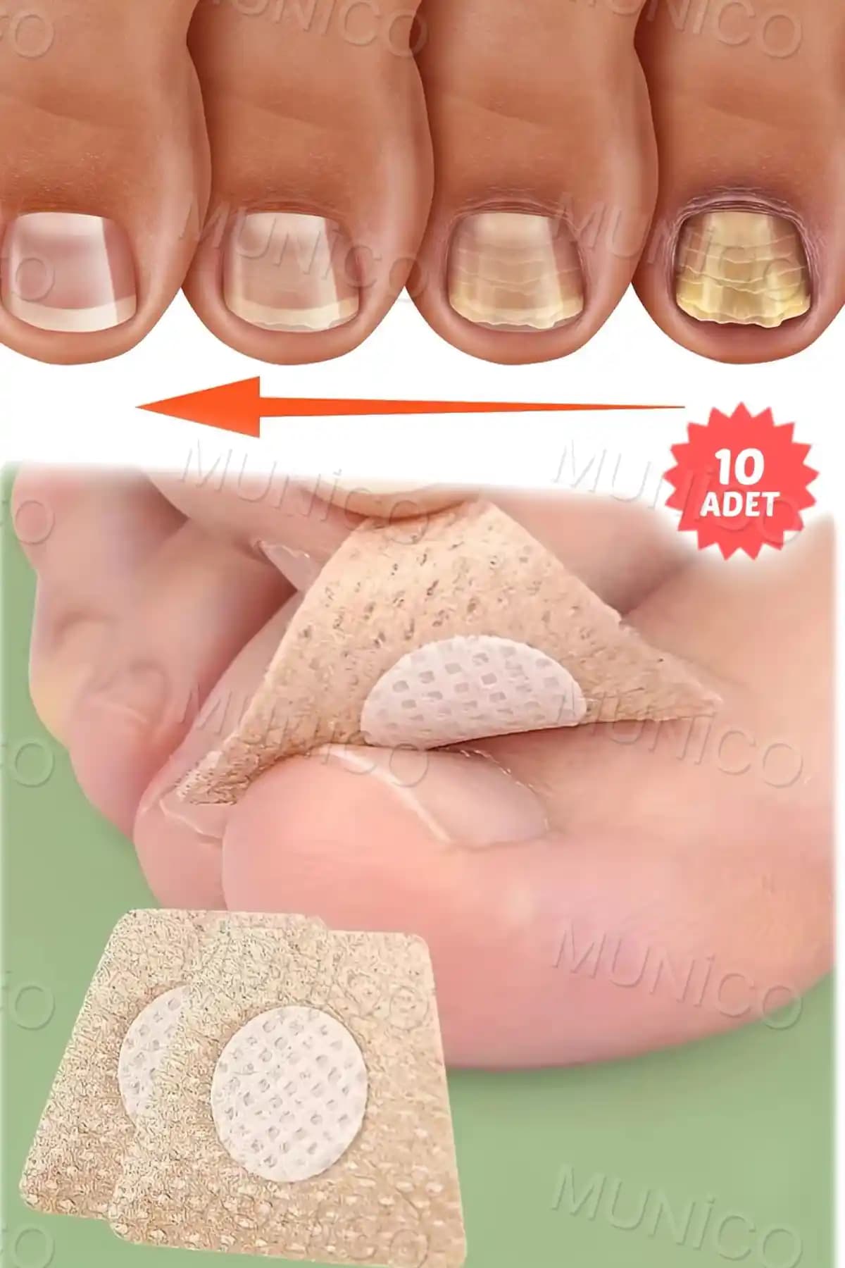 Munico 10 Çift Mantar Tırnak Yaması: Güçlü ve Yenileyici Tedavi Seçeneği