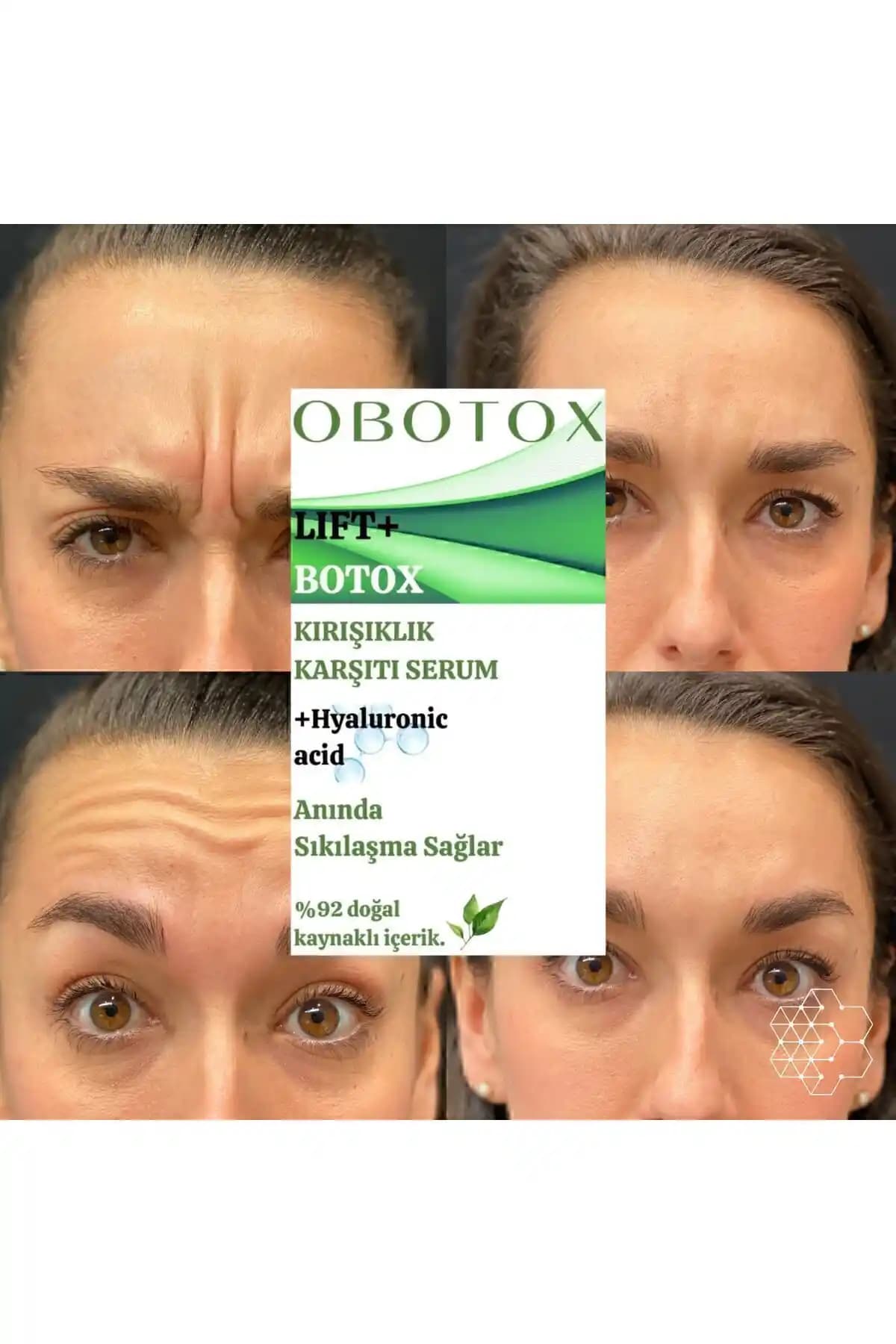 ObotoX Botoks Etkili Krem: Yaşlanma ve Kırışıklık Karşıtı Güçlü Çözüm