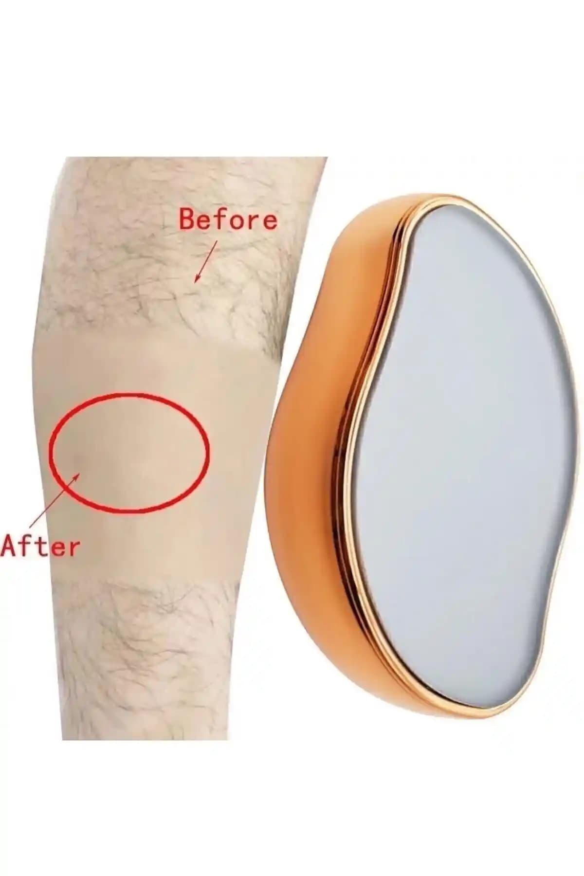 The Lady Beauty Shop Kristal Epilatör: Evde Profesyonel Sonuçlar İçin Güvenilir Cilt Bakım Cihazı