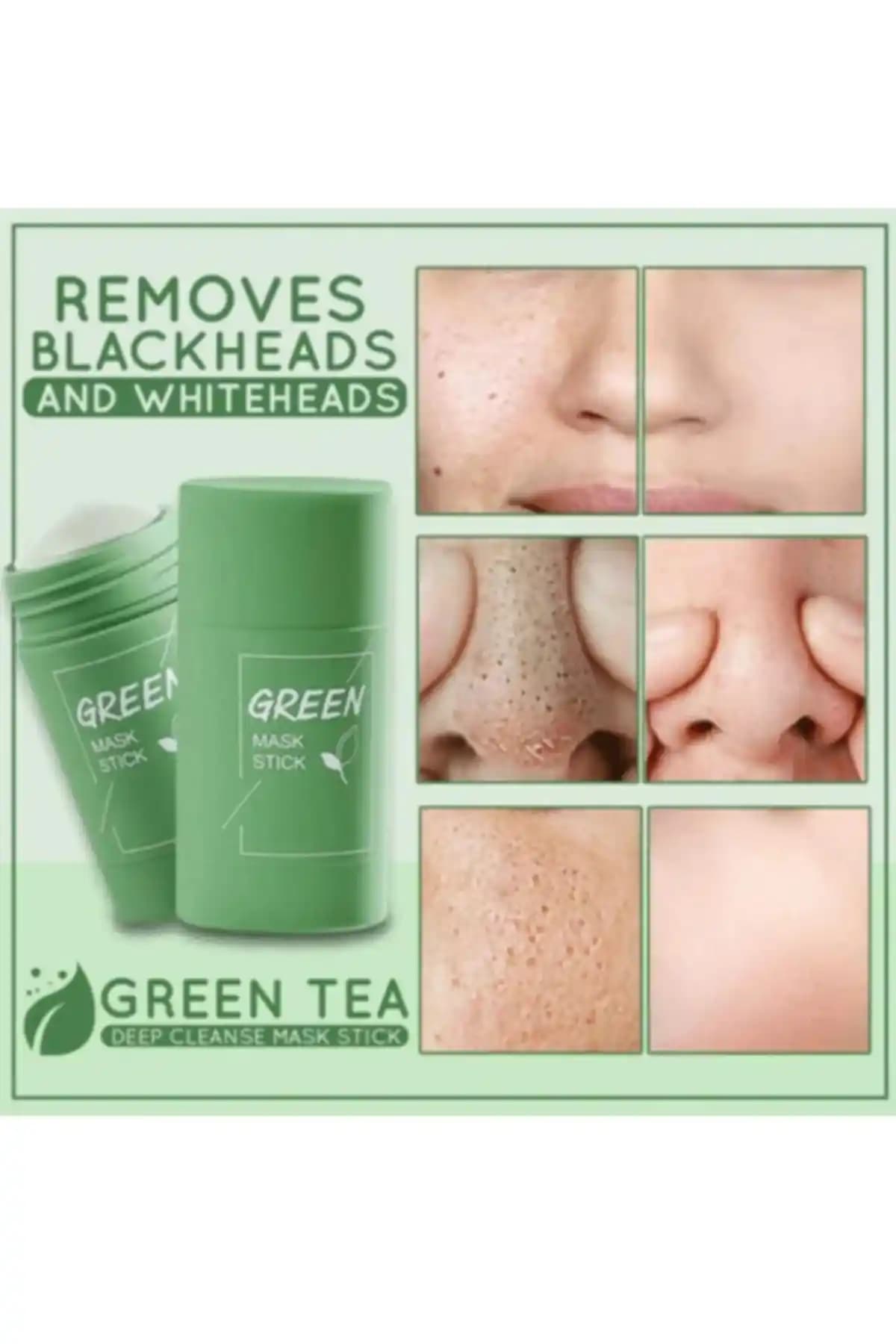 Yeşil Çay Özlü Siyah Nokta ve Sivilce Maskesi: Doğal ve Etkili Cilt Temizliği Ürünü