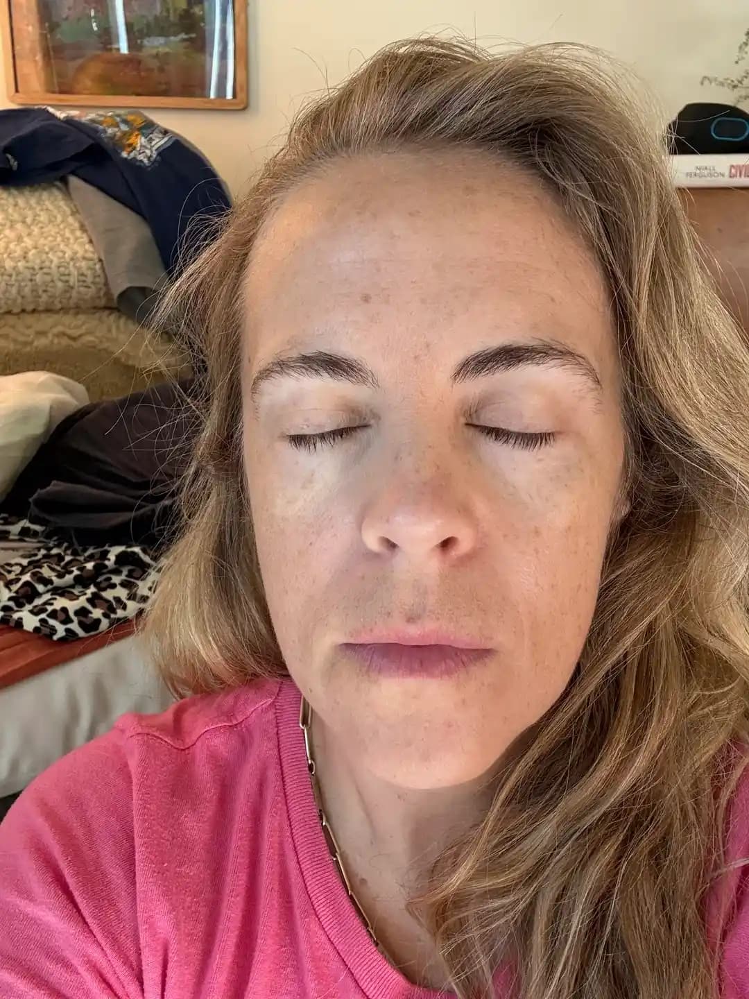 46 Yaş ve Üzeri Cilt Bakımında İleri Düzey Ürün ve Medikal Estetik Yaklaşımlar