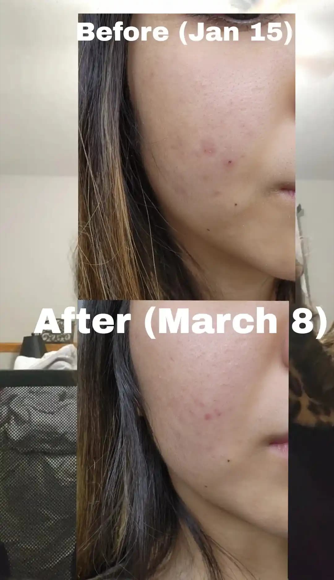 Azelaik Asidin Cilt Bakımındaki Rolü ve Etkili Kullanım Yöntemleri