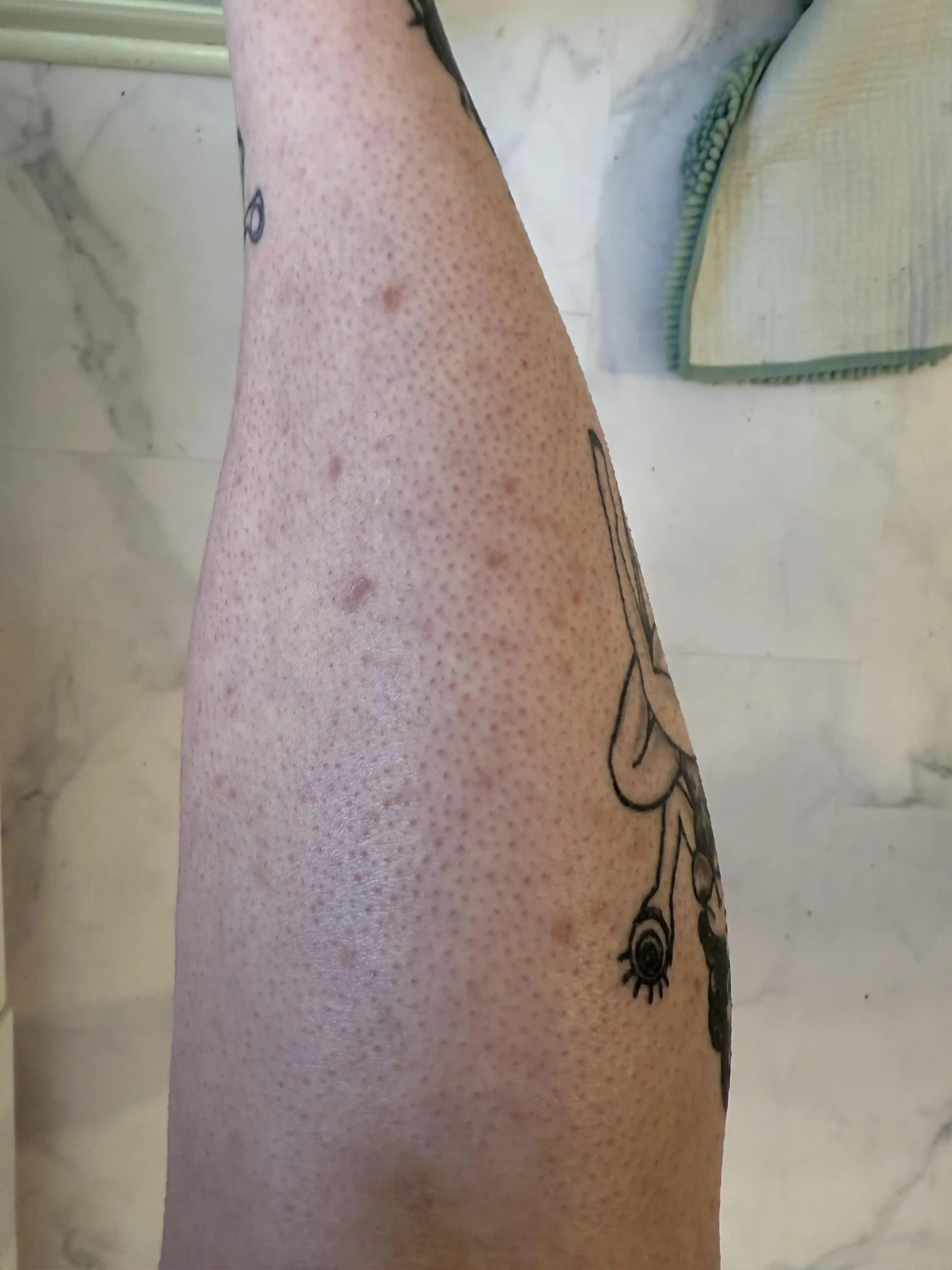 Bacaklarda Pürüzlü ve Benekli Cilt Görünümünü İyileştirme Yöntemleri ve Bakım Önerileri