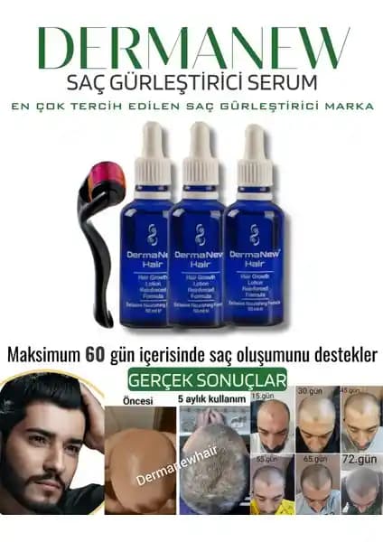 Dermanew Hair Losyonu ile Saç Dökülmesini Azaltan ve Saç Sağlığını Destekleyen Doğal Çözüm