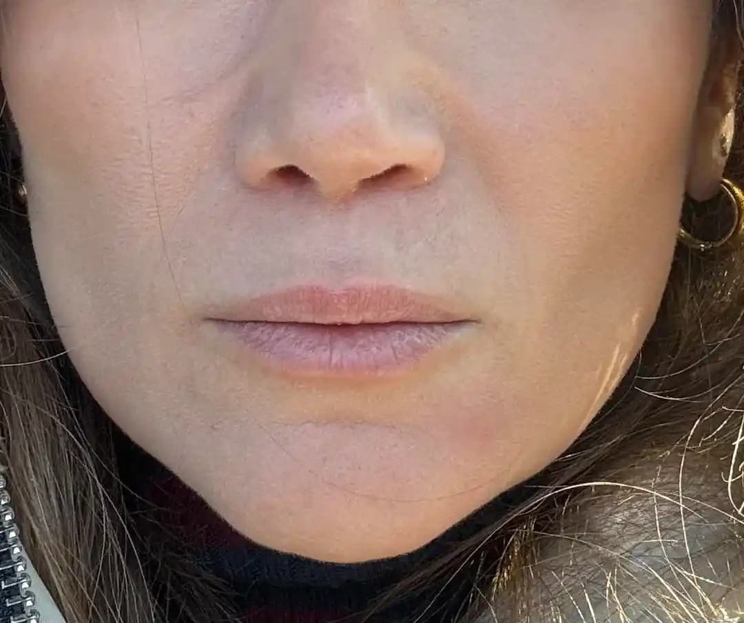 Fondötenin Ciltte Pürüzlü Görünümünün Nedenleri ve Etkili Çözüm Yolları