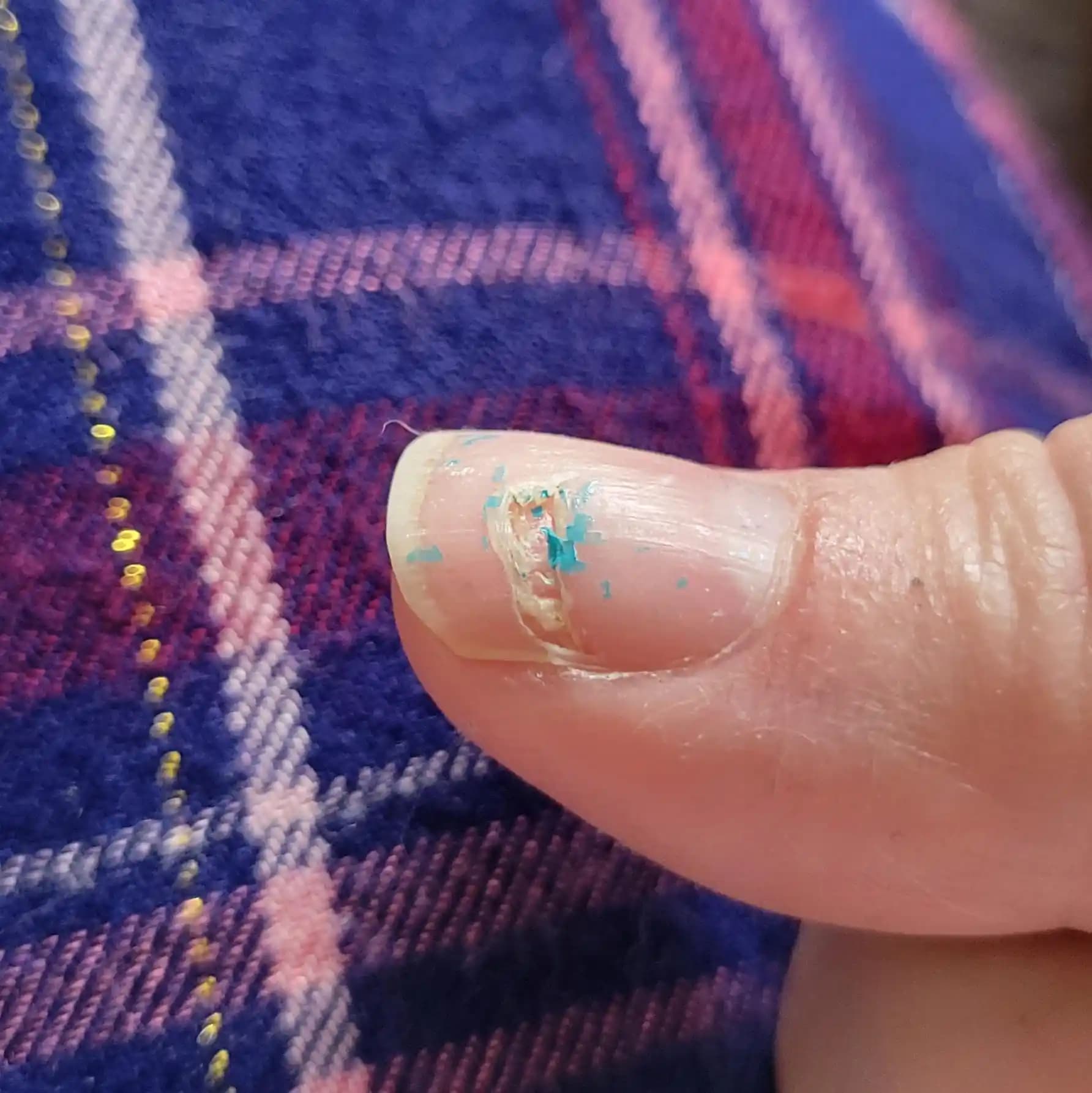 Kırık Tırnakların Doğru Bakımı ve Korunması İçin Etkili Yöntemler