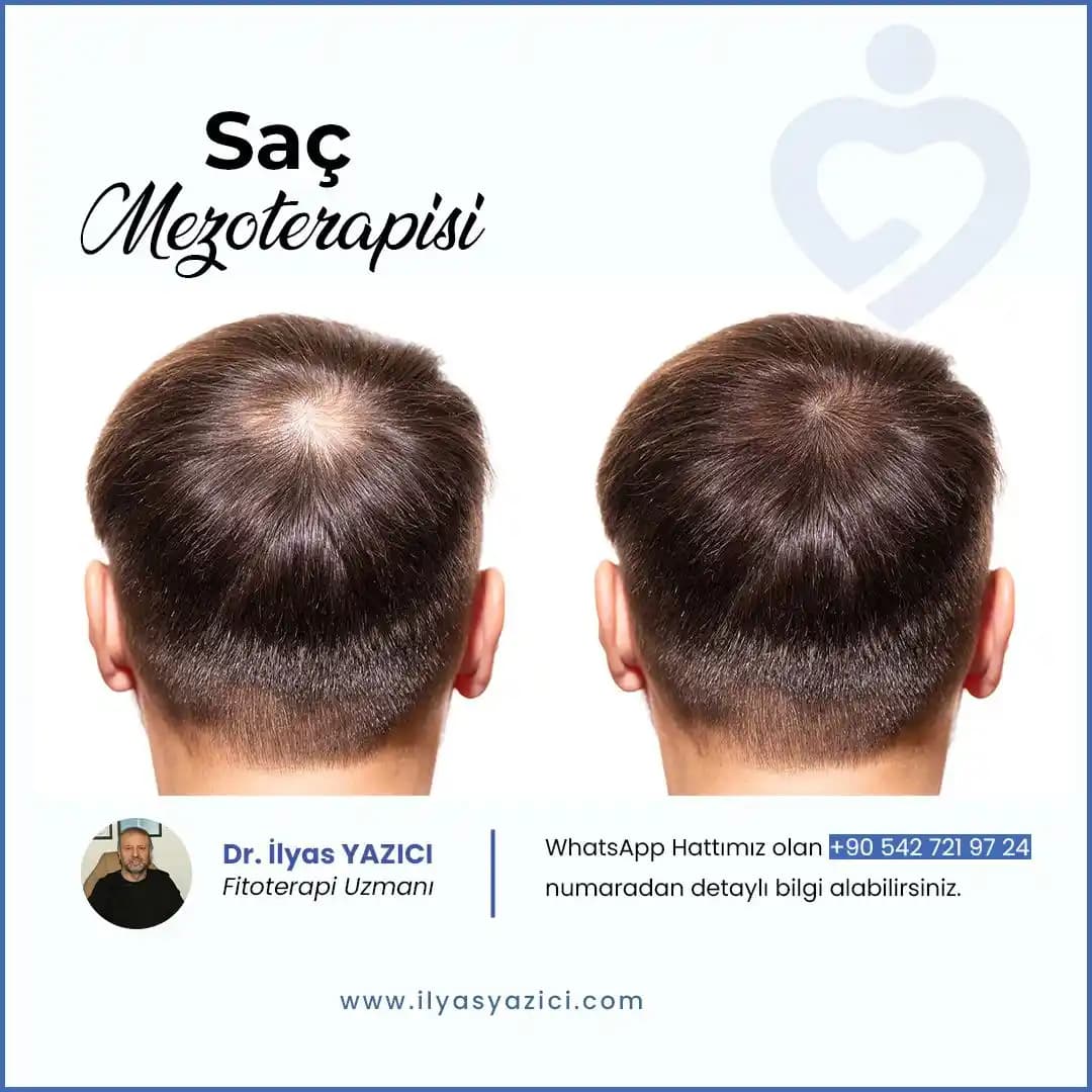 Saçın Moleküler Düzeyde Emilimi ve Bakım Ürünlerinin Etkileri Üzerine Bilimsel İnceleme