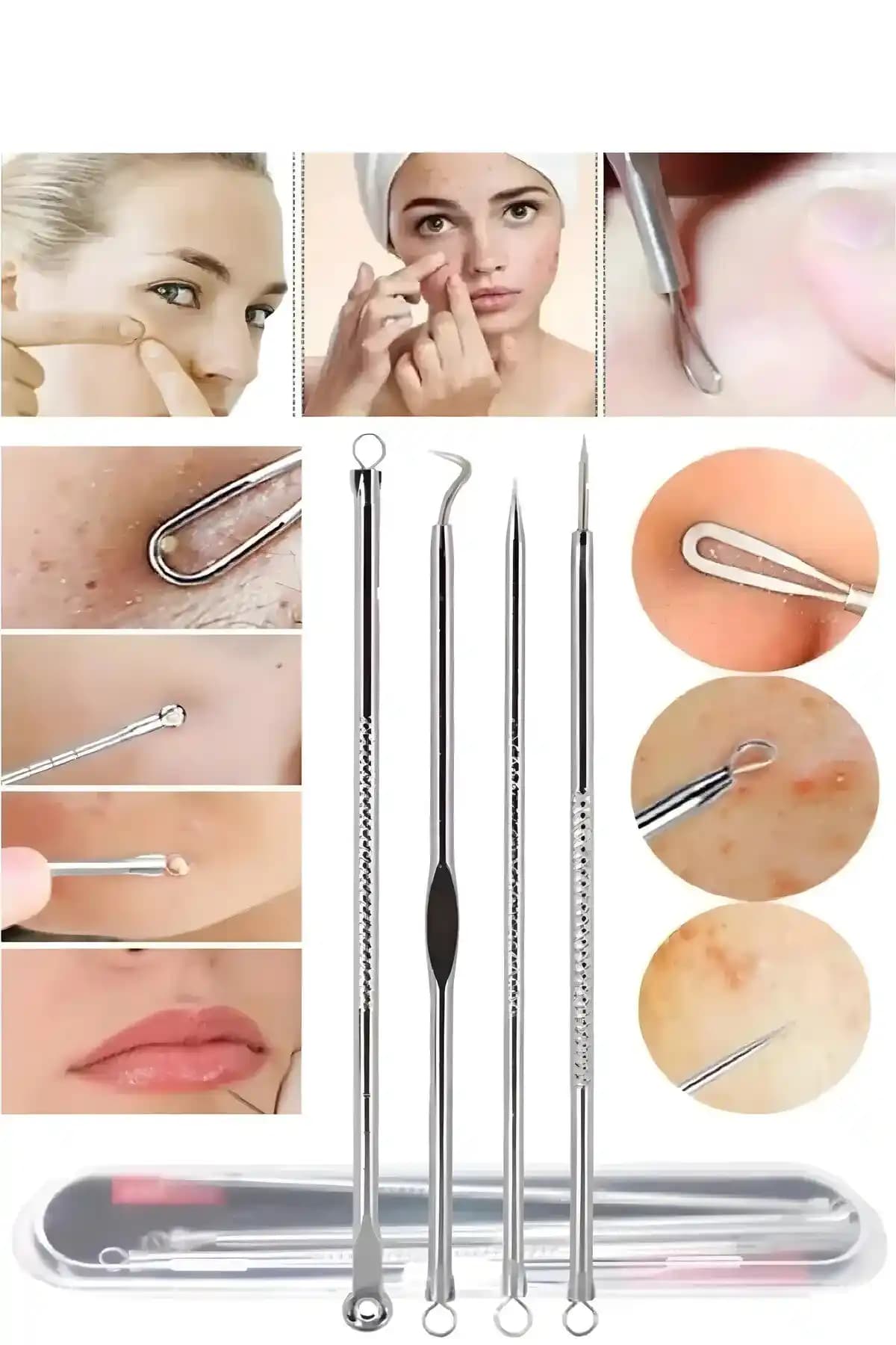 Akne Lekeleri ve Cilt Temizliği İçin Güncel Ürünler ve Teknolojiler Hakkında Bilgi