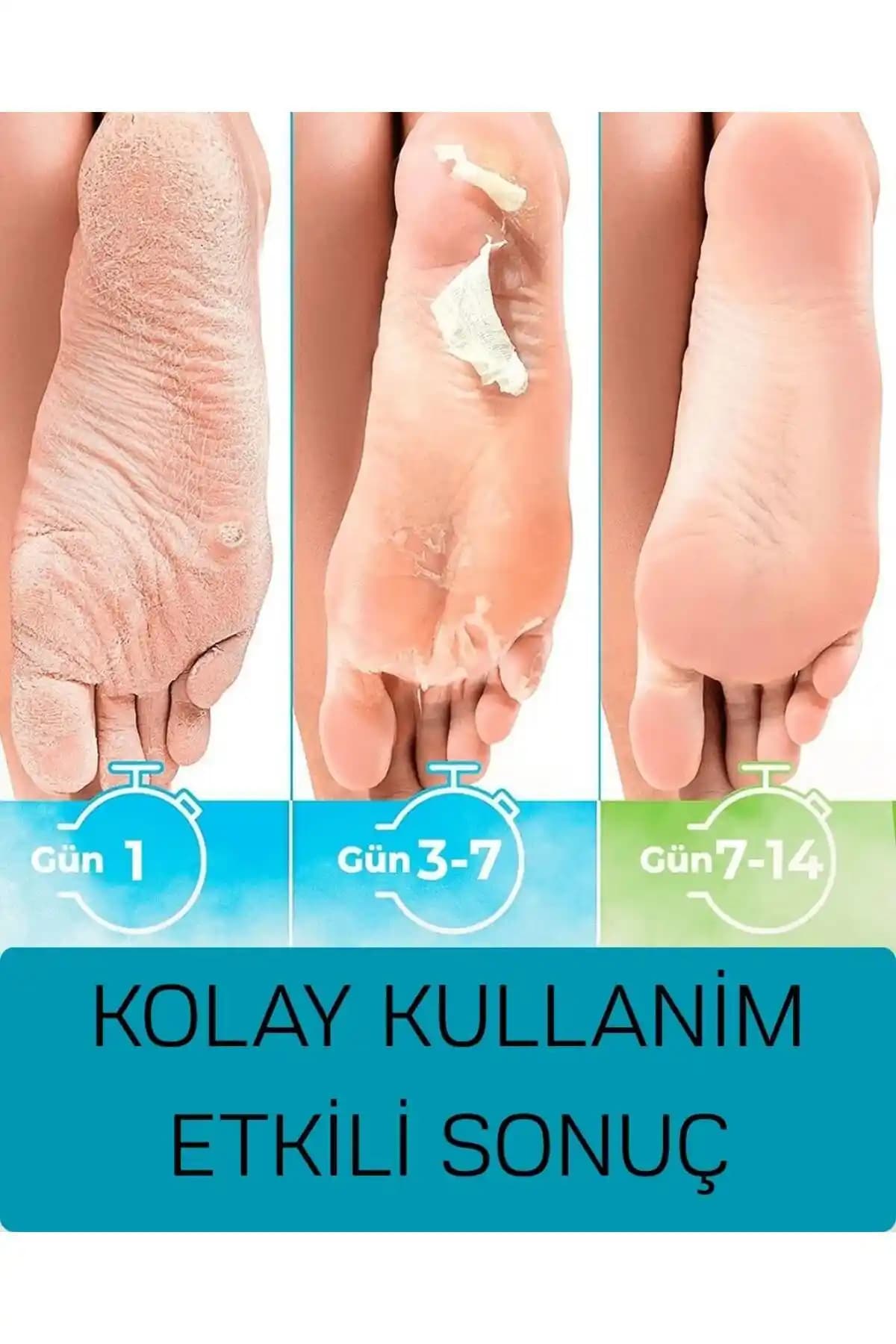 BİO SHOES Ayak Soyucu Peeling Maskesi İncelemesi ve Kullanım Rehberi