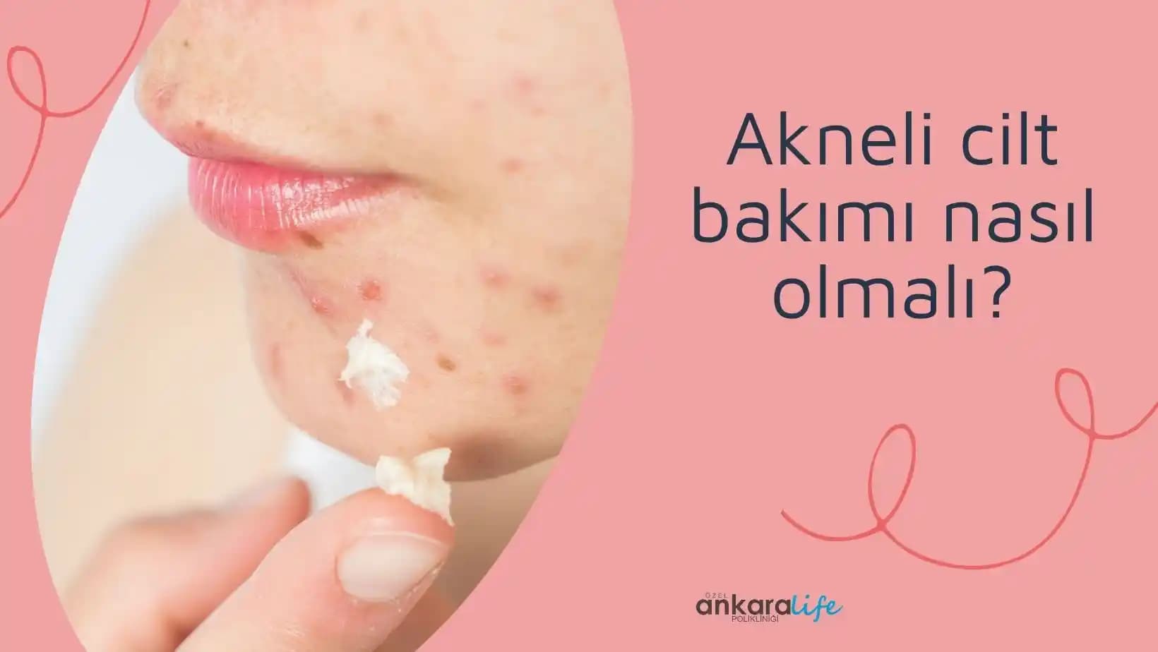 Akne ile Mücadelede Doğru Cilt Bakımı Rehberi: Temizlik, Ürün Seçimi ve Yaşam Tarzı