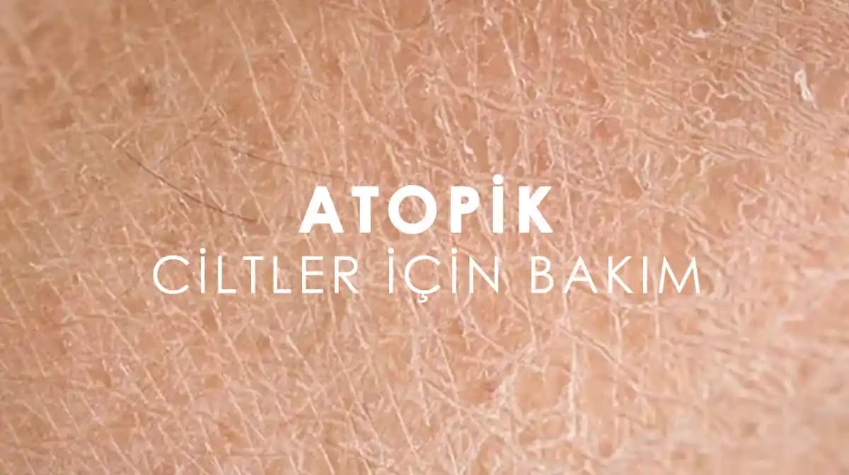 Atopik Cilt Tipi Nedir, Belirtileri ve Bakım Yöntemleri Hakkında Detaylı Bilgi