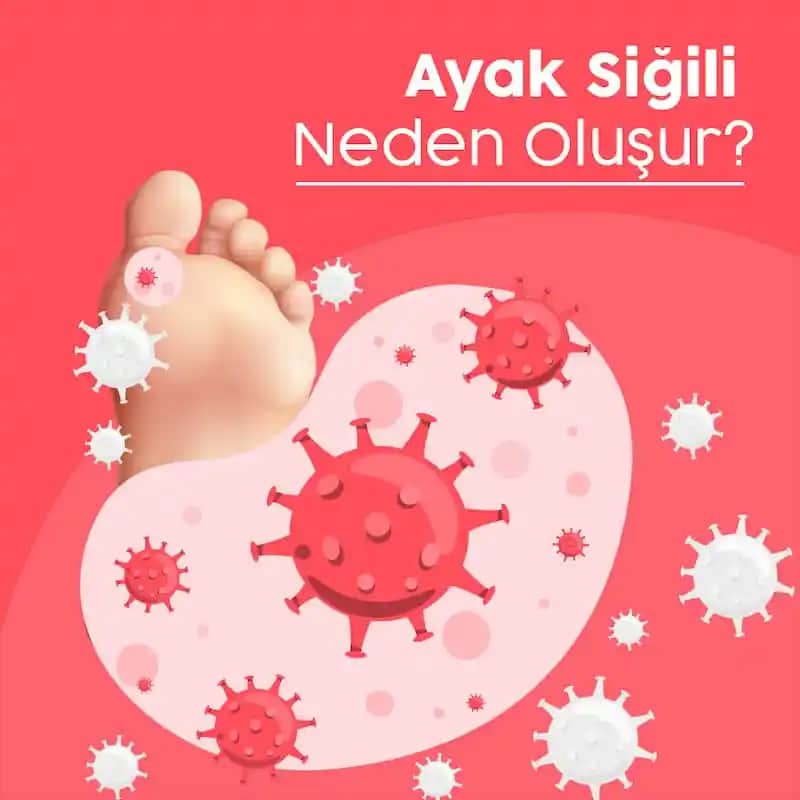 Ayakta Pişik Nedenleri Belirtileri ve Etkili Tedavi Yöntemleri Rehberi