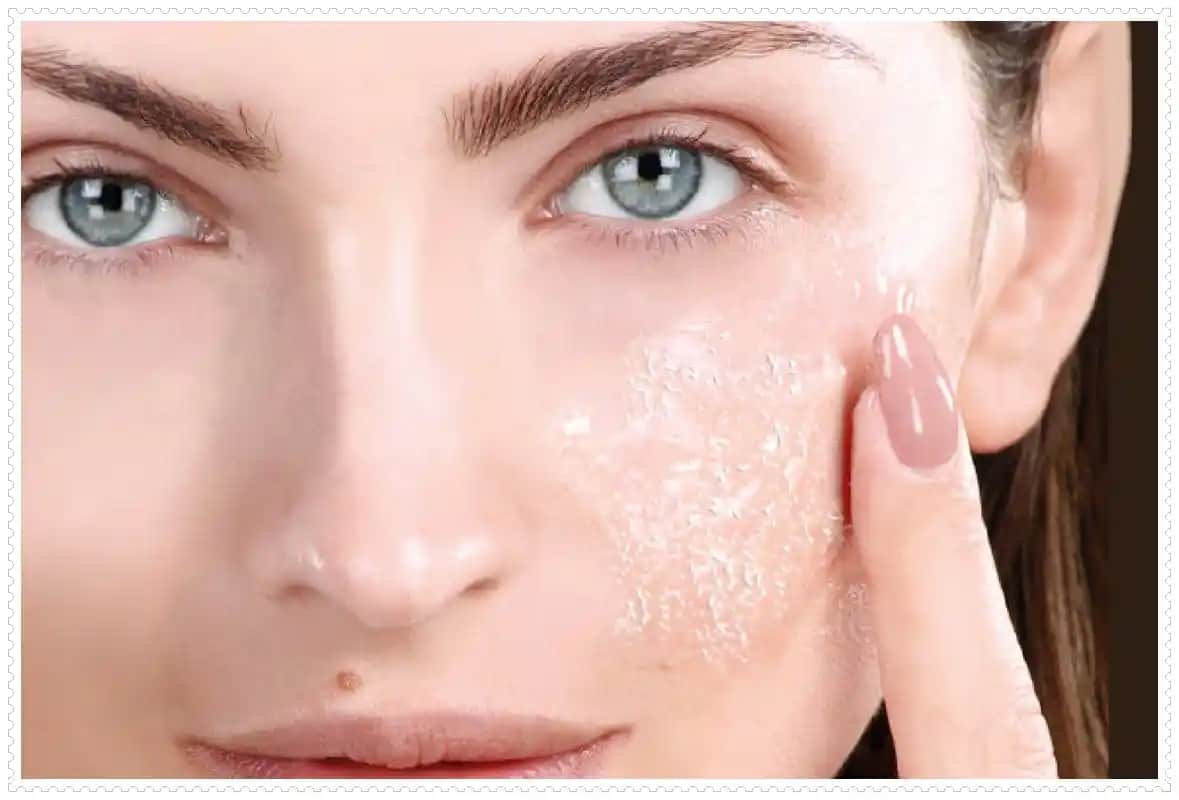 Ciltte Pul Pul Dökülme Nedenleri Belirtileri ve Etkili Çözüm Yolları