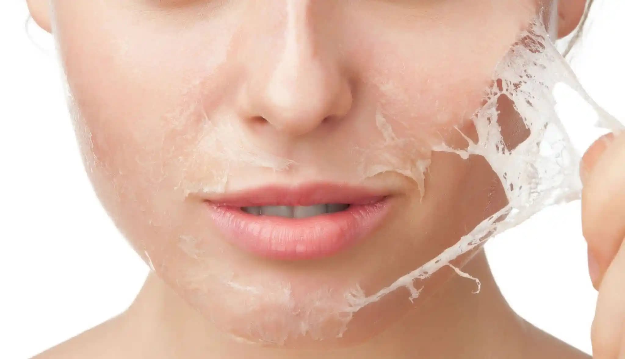 Doğru Peeling Uygulama Yöntemleri ve Cilt Bakımında Etkili Kullanım Rehberi