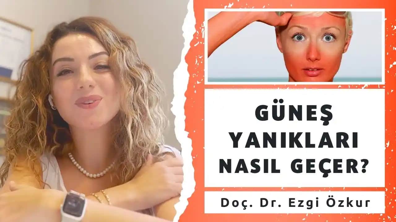 Güneş Yanıkları Nasıl Geçer ve Güneşten Korunma Yöntemleri