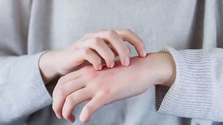 Kozmetik Alanda Kaşıntı Tedavisi ve Güvenli Ürün Seçimi Rehberi