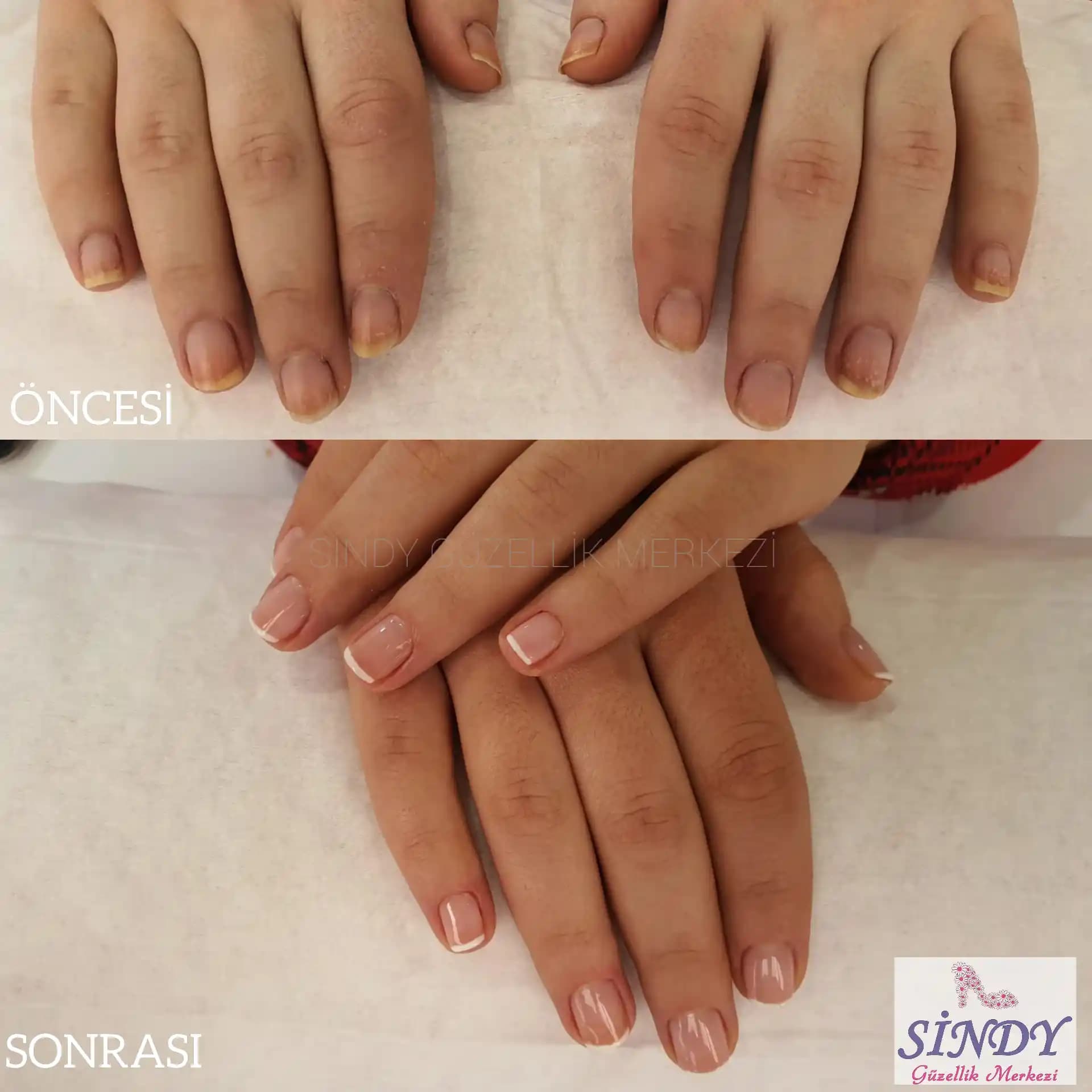 Manikür ve Pedikür Öncesi ve Sonrası Bakım Rehberi ve İpuçları