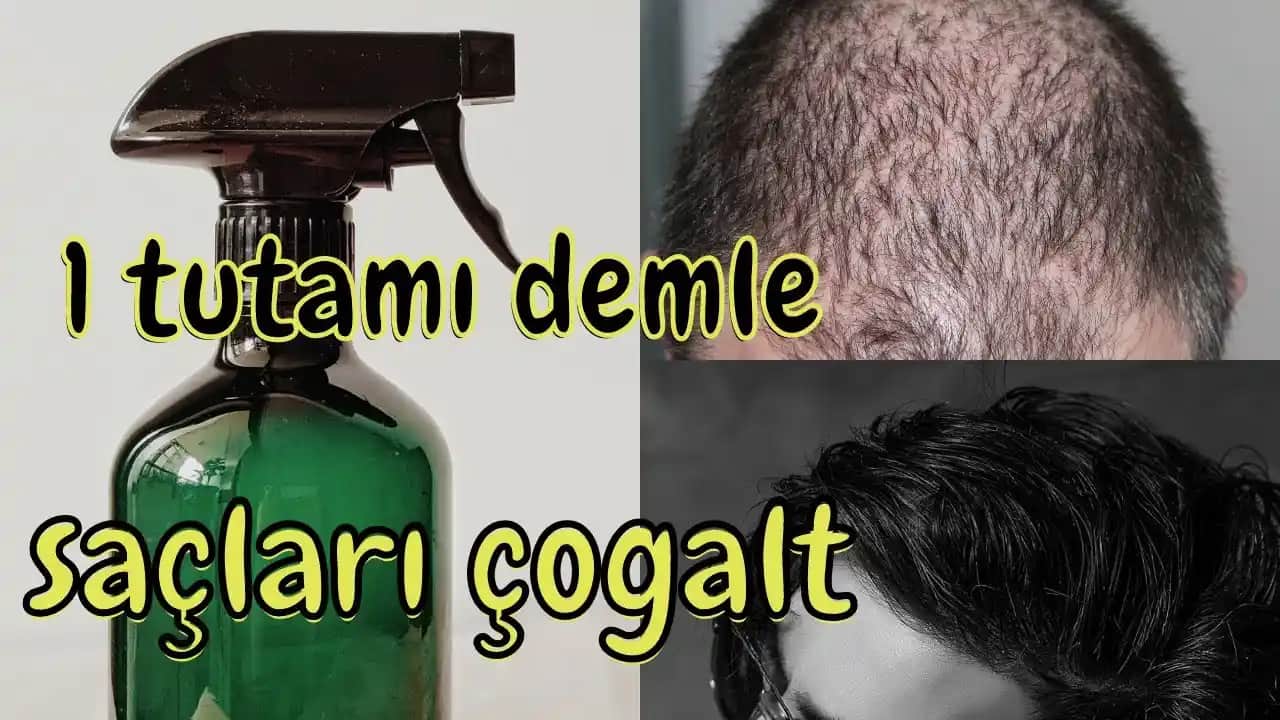 Saç Dökülmesine Karşı Doğal Yöntemler ve Saç Sağlığını Destekleyen İpuçları