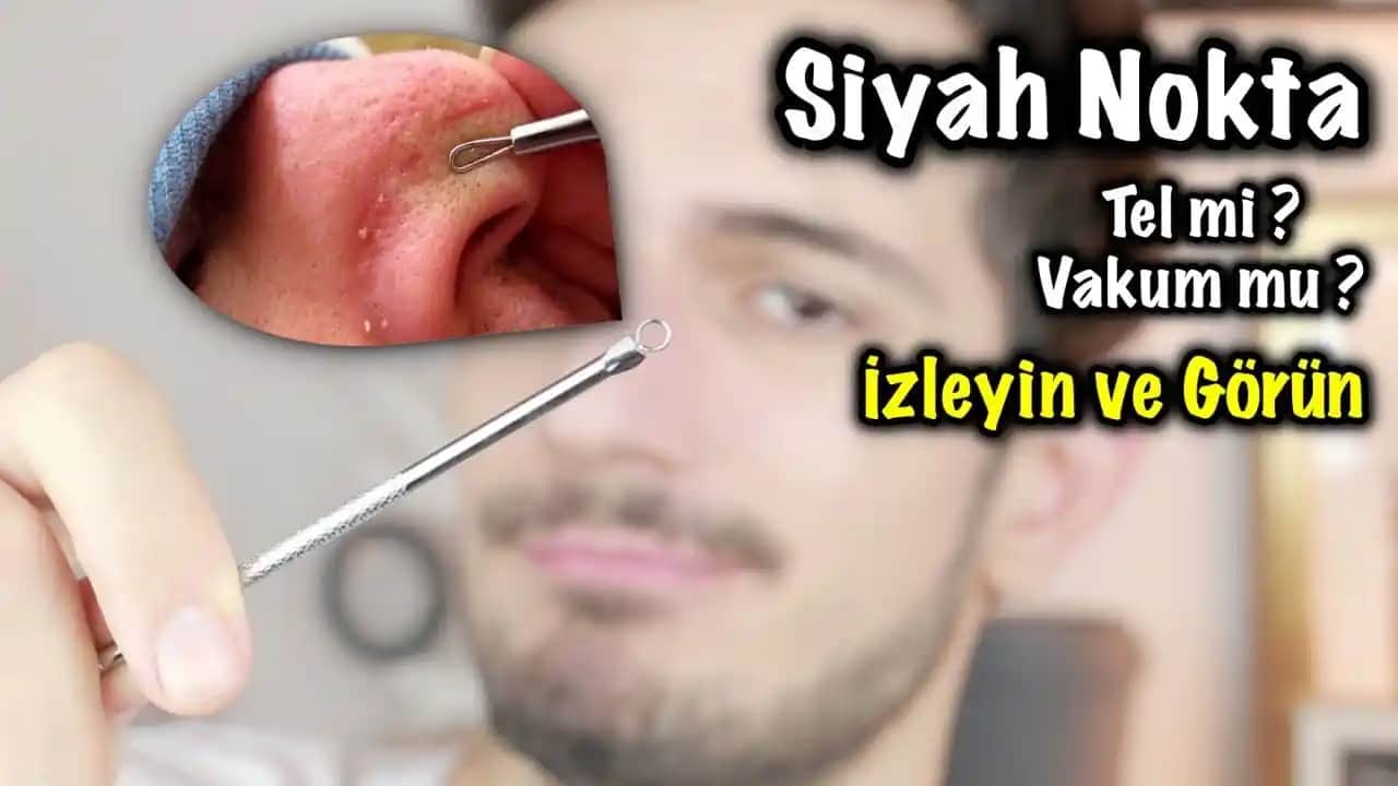 Siyah Nokta Temizleme Aleti Kullanımı Rehberi: Doğru Uygulama ve İpuçları