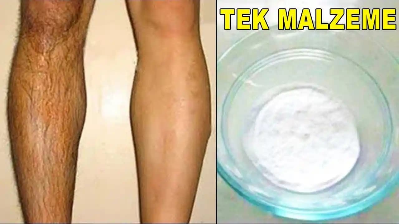 Tüyleri Kökten Yok Eden Kremler: Etkili ve Güvenilir Çözüm Rehberi